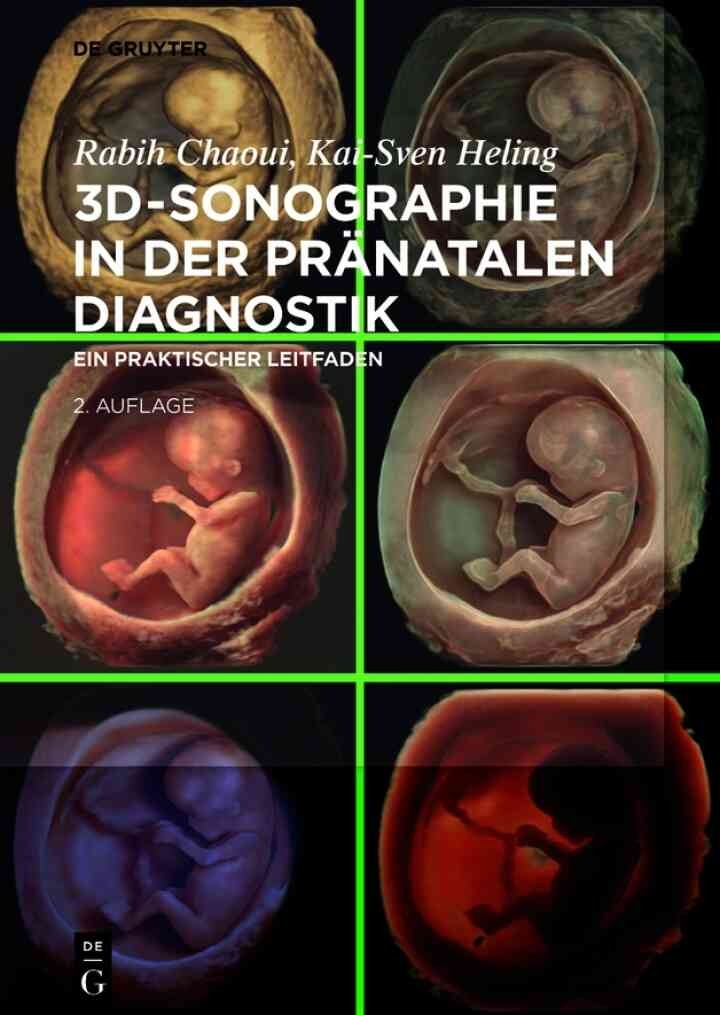 3D-Sonographie in der pränatalen Diagnostik: Ein praktischer Leitfaden