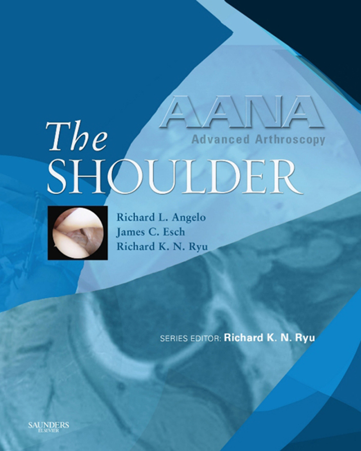 AANA Advanced Arthroscopy: The Shoulder - Electronic