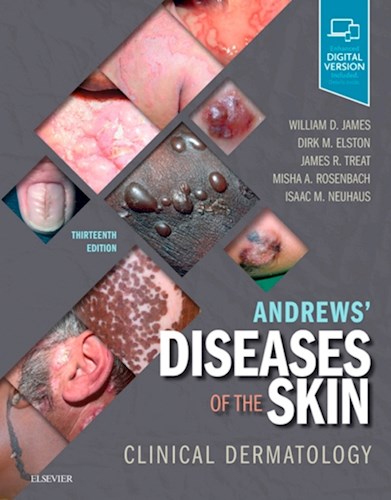 Andrews' Diseases of the Skin E-Book Clinical Dermatology