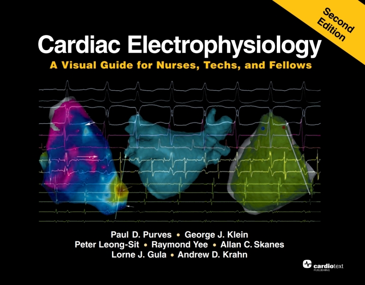 Cardiac Electrophysiology: A Visual Guide for Nurses, Techs, and Fellows, Second Edition