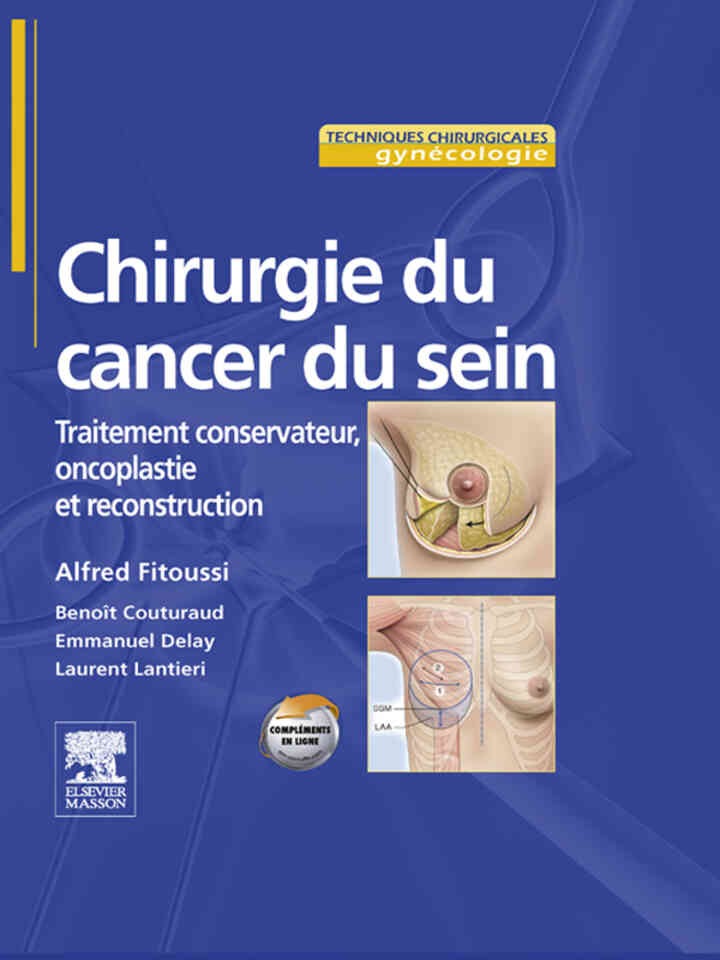 Chirurgie du cancer du sein: Traitement conservateur, oncoplastie et reconstruction