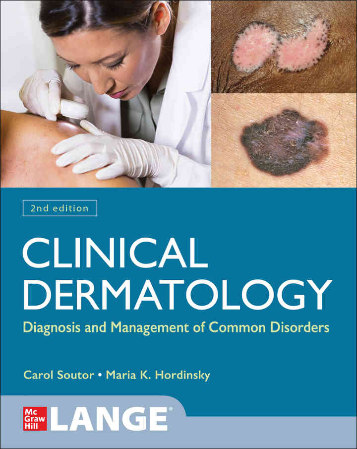 Clinical Dermatology: Diagnosis and Management of Common Disorders