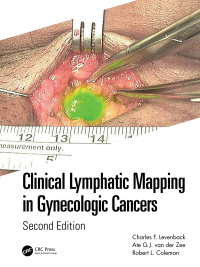 Clinical Lymphatic Mapping in Gynecologic Cancers