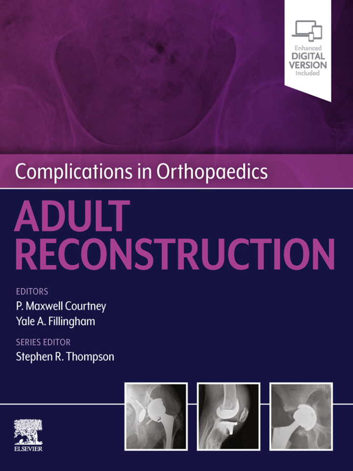 Complications in Orthopaedics: Adult Reconstruction - E-Book
