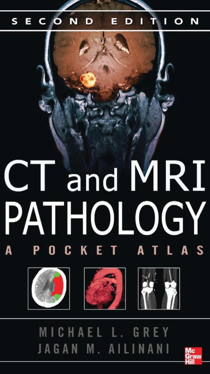 CT & MRI Pathology: A Pocket Atlas Second Edition