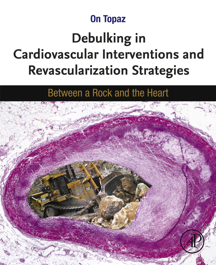 Debulking in Cardiovascular Interventions and Revascularization Strategies : Between a Rock and the Heart