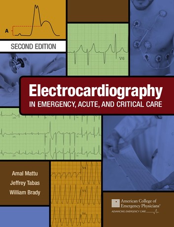 Electrocardiography in Emergency Acute and Critical Care 2nd Edition