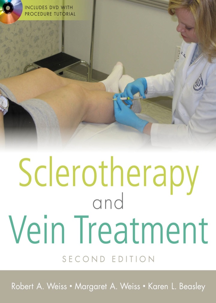 Sclerotherapy and Vein Treatment
