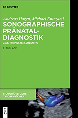 Sonographische Pr�nataldiagnostik: Zweittrimesterscreening