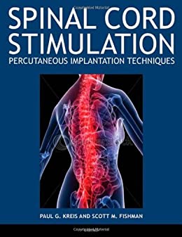 Spinal Cord Stimulation: Percutaneous Implantation Techniques