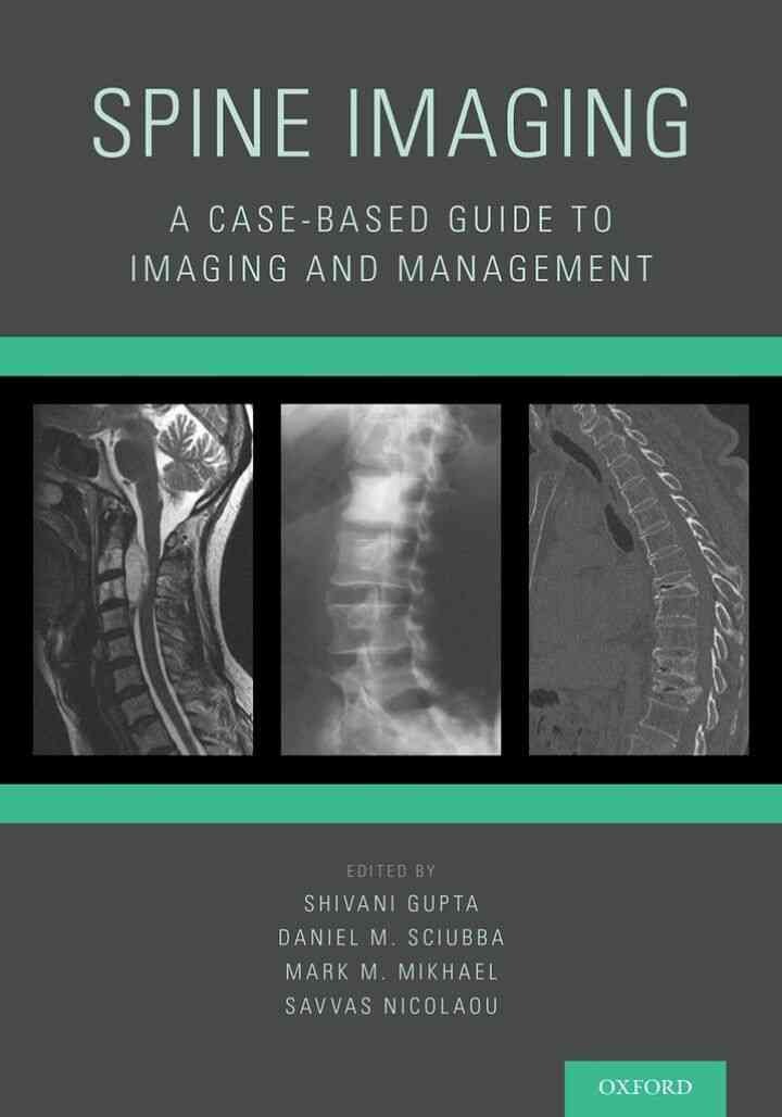 Spine Imaging: A Case-Based Guide to Imaging and Management, 1st Edition