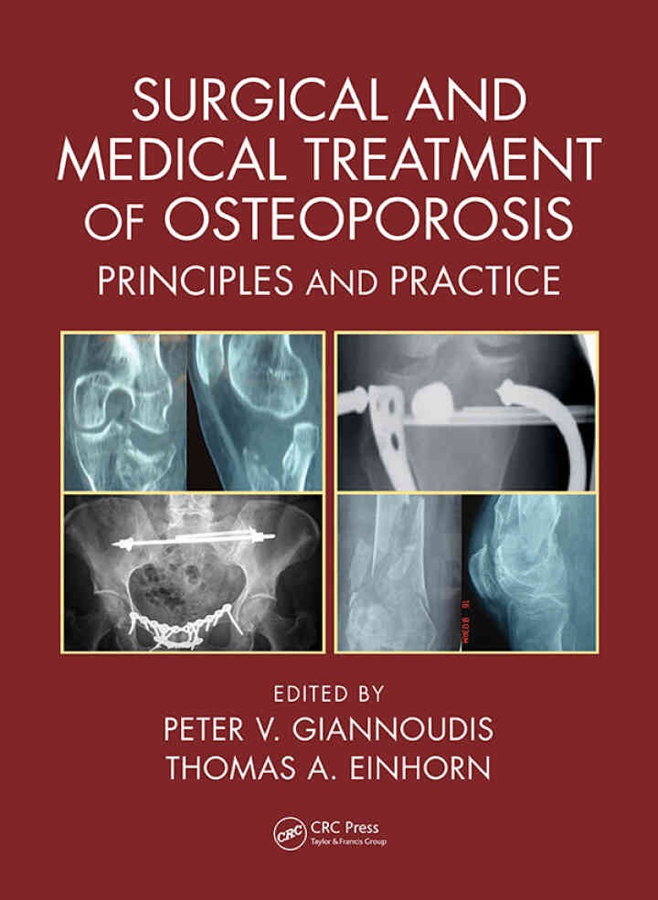 Surgical and Medical Treatment of Osteoporosis: Principles and Practice, 1st Edition