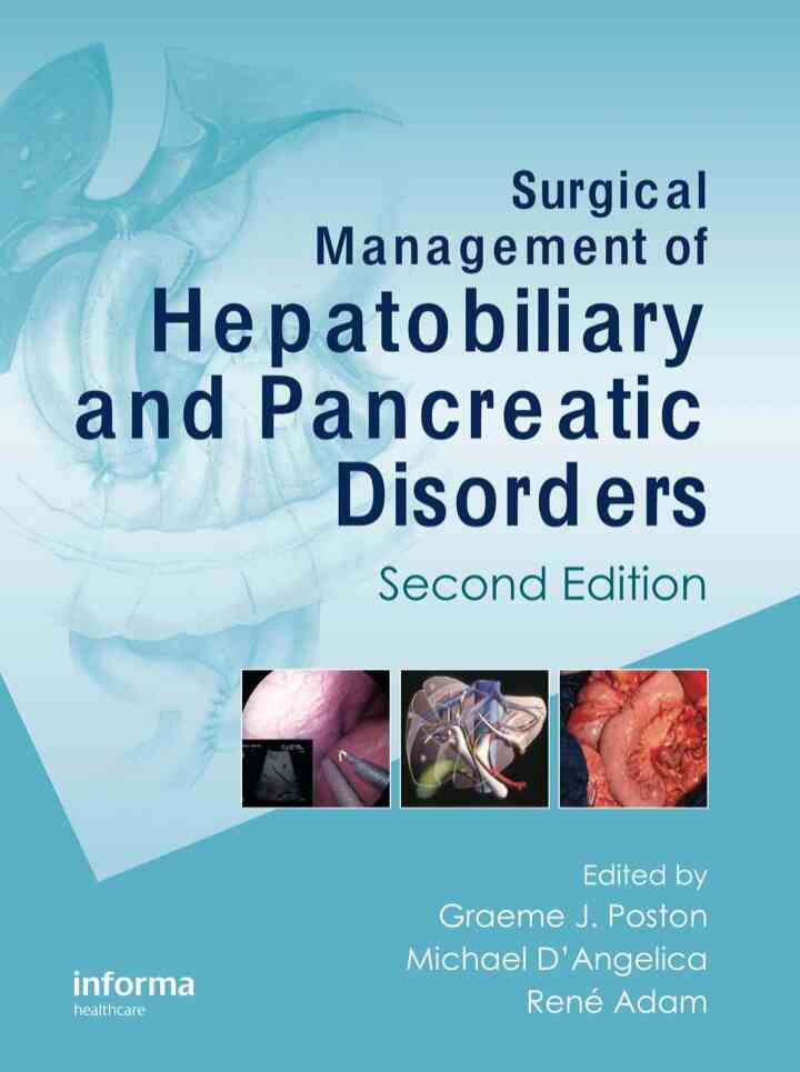 Surgical Management of Hepatobiliary and Pancreatic Disorders