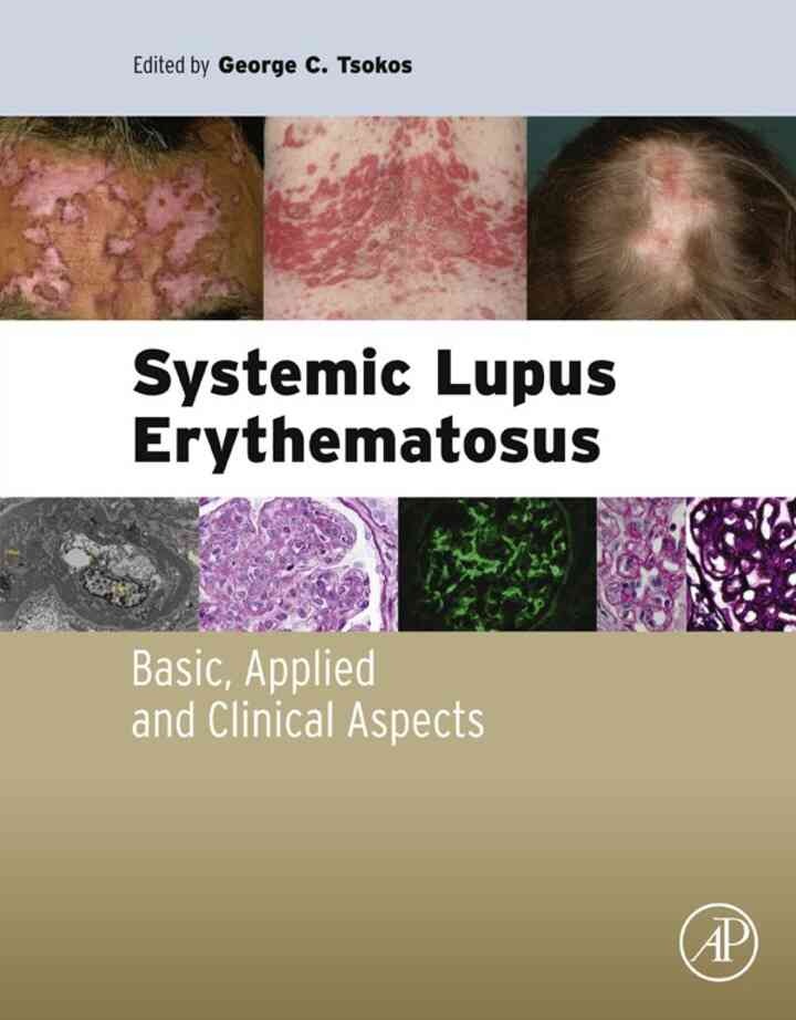Systemic Lupus Erythematosus: Basic, Applied and Clinical Aspects
