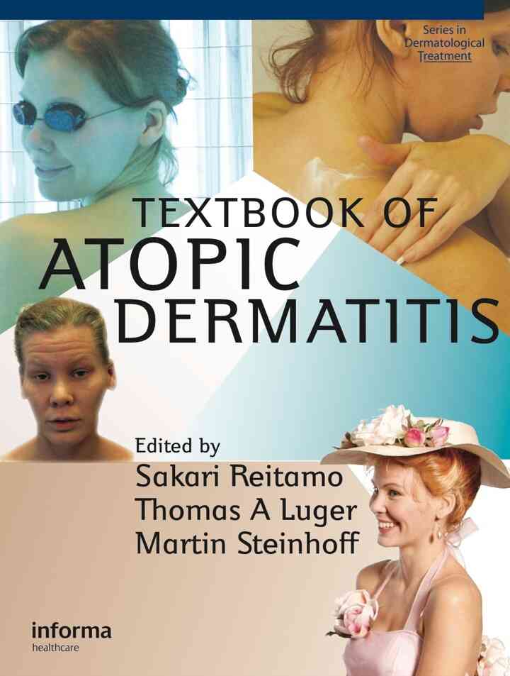 Textbook of Atopic Dermatitis