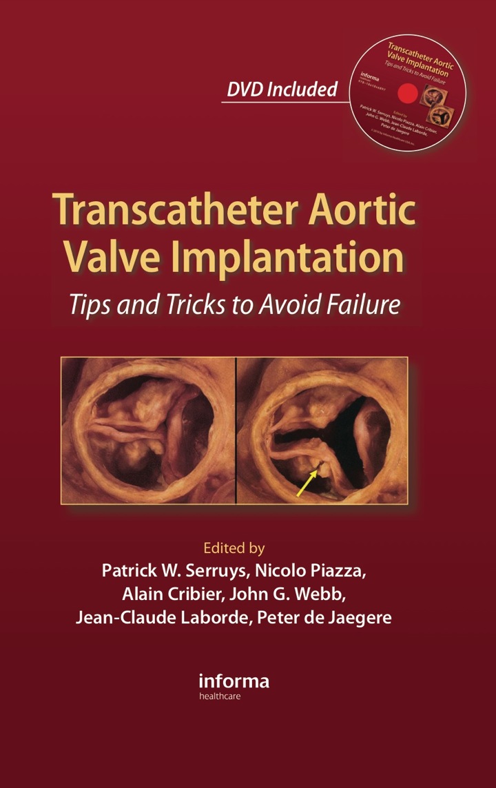 Transcatheter Aortic Valve Implantation: Tips and Tricks to Avoid Failure