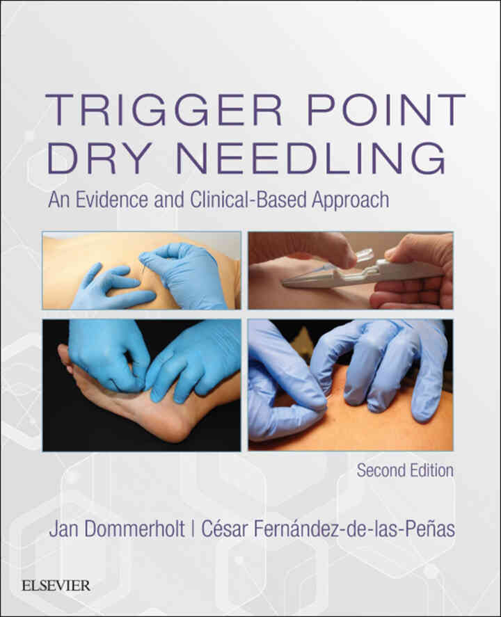 Trigger Point Dry Needling: An Evidence and Clinical-Based Approach, 2nd Edition