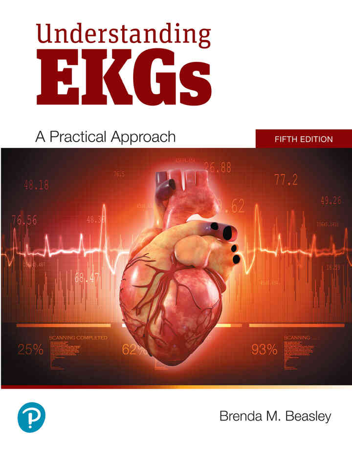 Understanding EKGs: A Practical Approach, 5th Edition