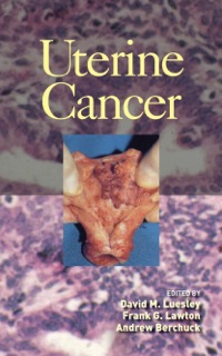 Uterine Cancer