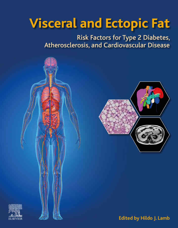 Visceral and Ectopic Fat: Risk Factors for Type 2 Diabetes, Atherosclerosis, and Cardiovascular Disease
